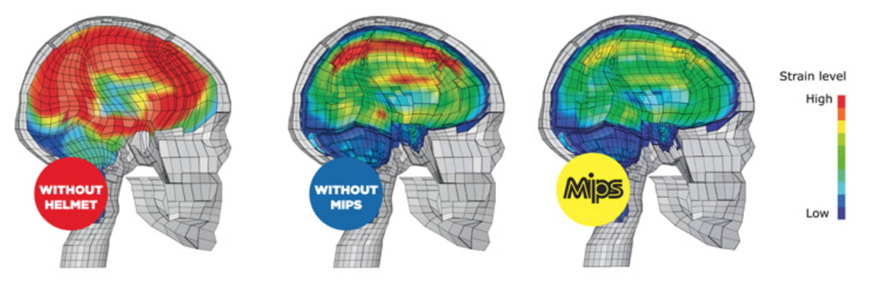 Brain strain levels